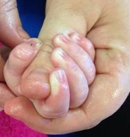 Benefits of Baby Massage and reflexology